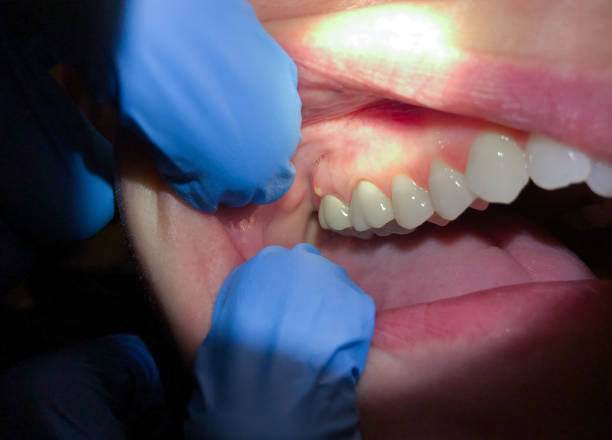 Best Emergency TMJ Treatment in Alliance, NE